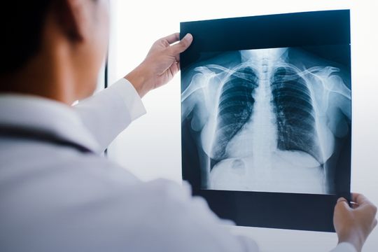 Radiology Equipment